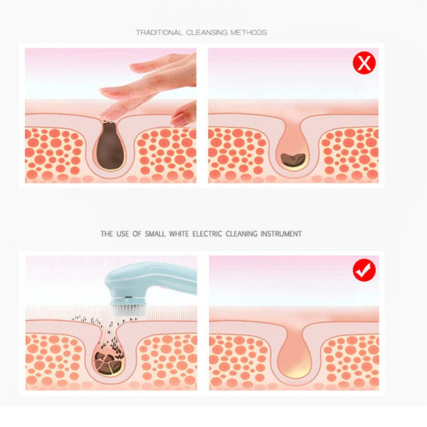 Cleansing Brush 4 in 1 Facial  Deep Clean, Blackhead Remover,